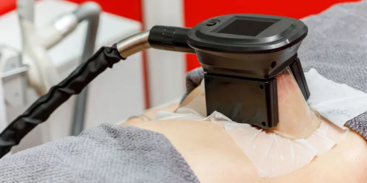 Know Everything About Fat Freezing Treatment And Its Working